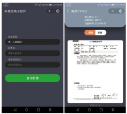 醫用電子膠片軟件med electronic film廠家